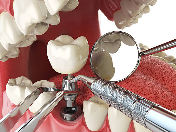 Best Emergency Treatment for Jaw Pain or Injury in Grandview, WA